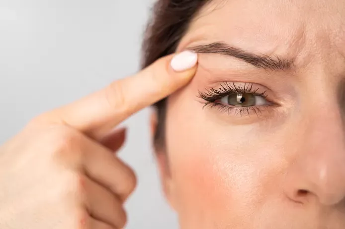 Comprendre la blépharoplastie - rajeunir le regard avec élégance