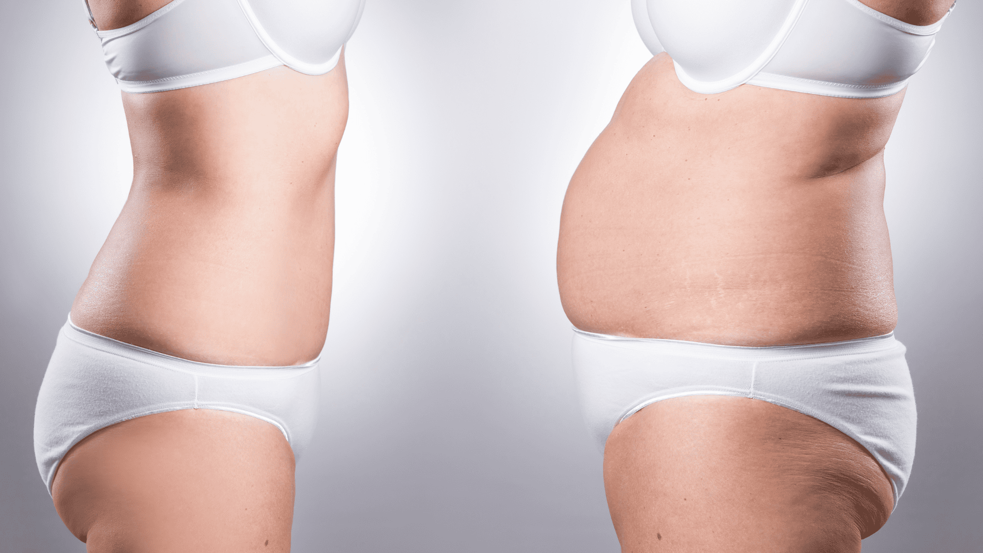 Laser Liposuction