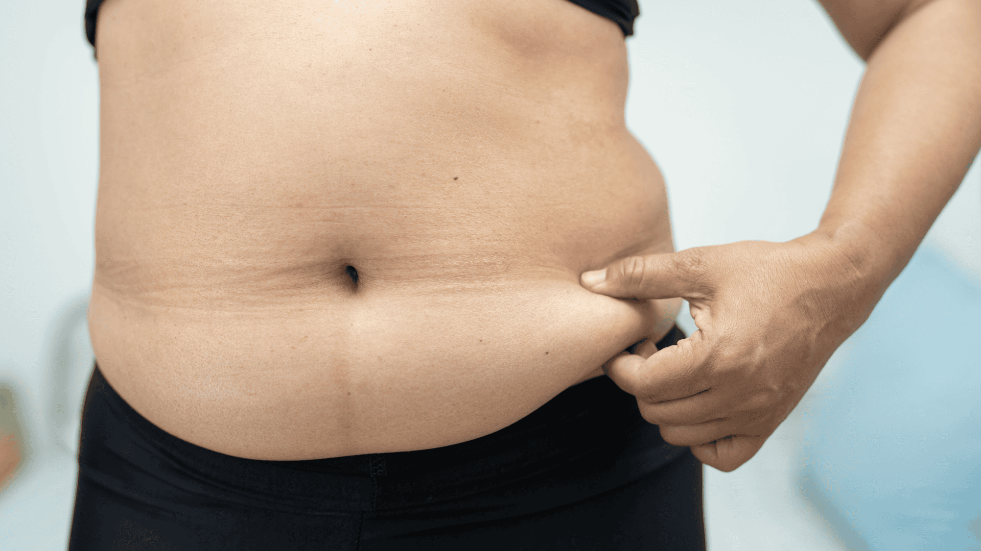 Mini Gastric Bypass